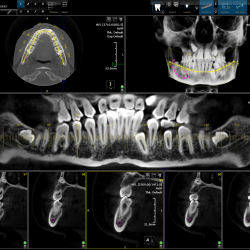 systems for dentists