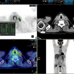 PET/CT